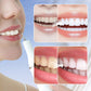 Ultradźwiękowy skaler dentystyczny z endoskopem i funkcją szybkiego ładowania✨🦷