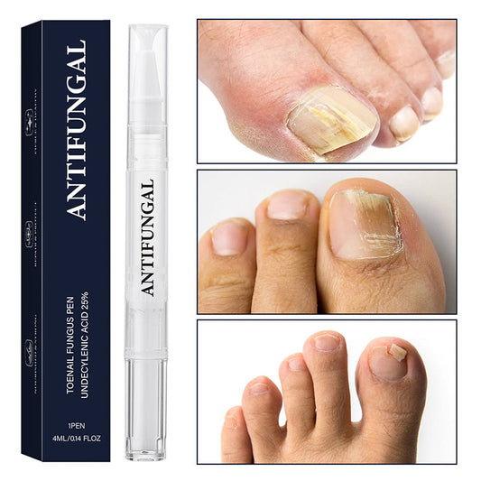 🔥Pióro do leczenia grzybicy paznokci, odpowiednie do paznokci zniszczonych