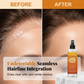 🔥✨Spray do topnienia koronki o ekstremalnym utrwaleniu — idealnie wtapia się w skórę💇‍♀️